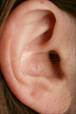 ear-closeup.jpg